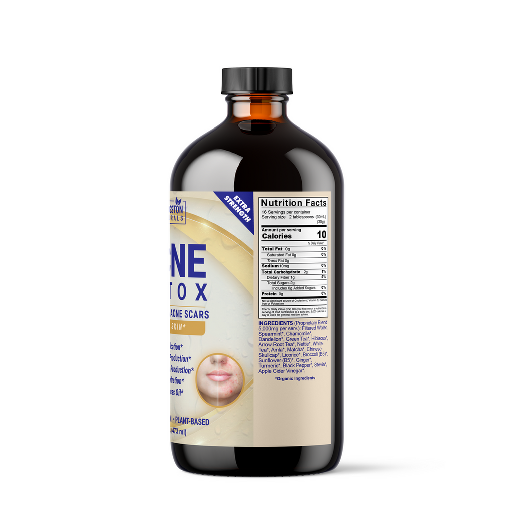ACNÉ DETOX 16 oz.