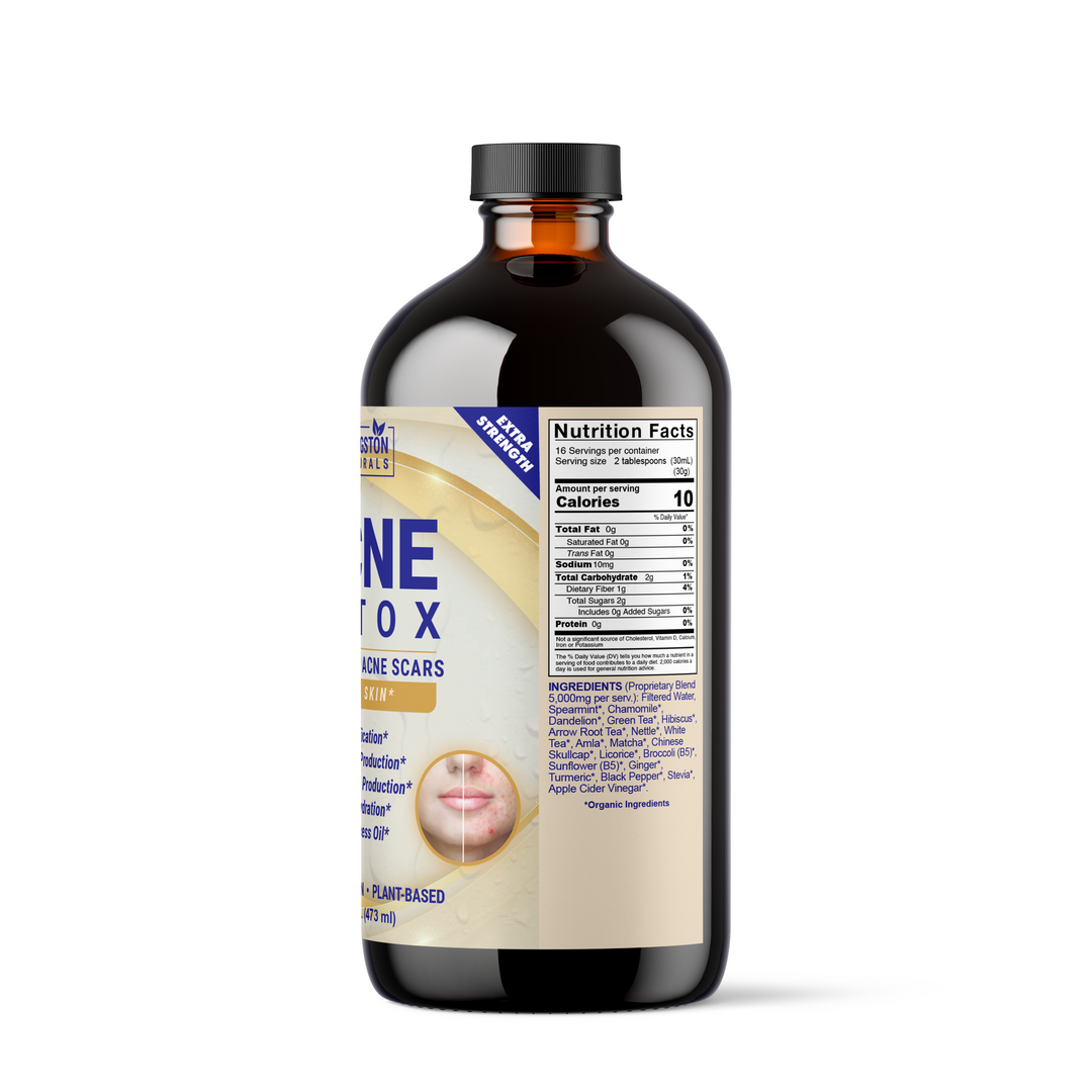 ACNÉ DETOX 16 oz.